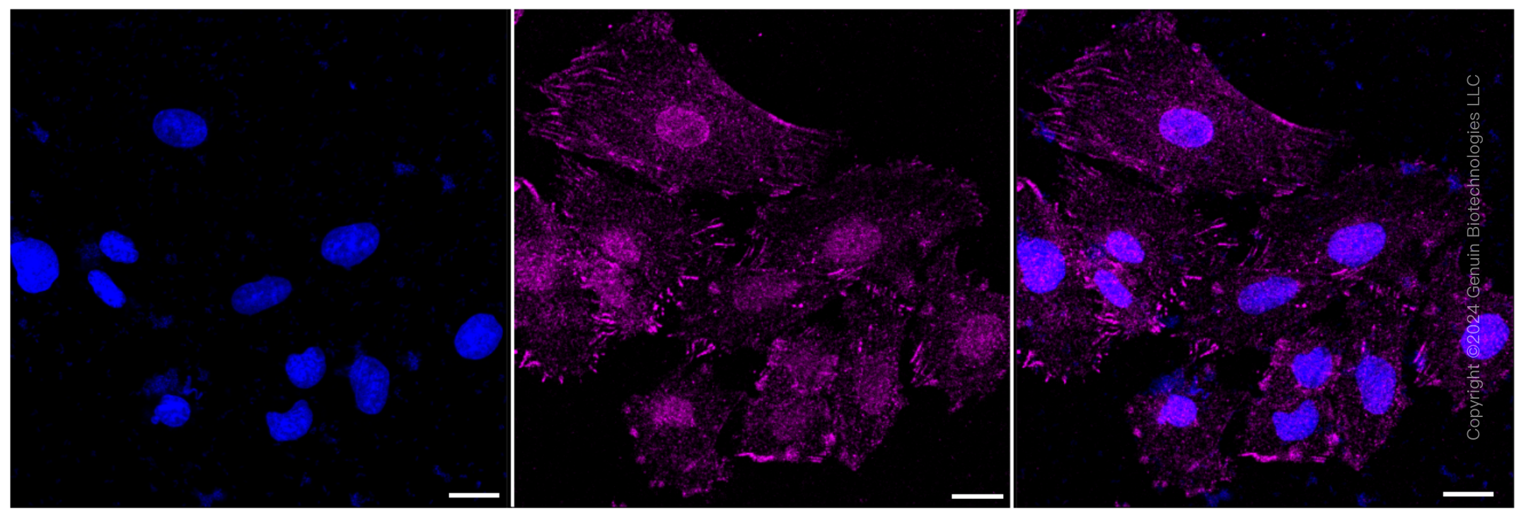 KD-Validated DSTN Rabbit mAb (20 μl) 61122 IC 1