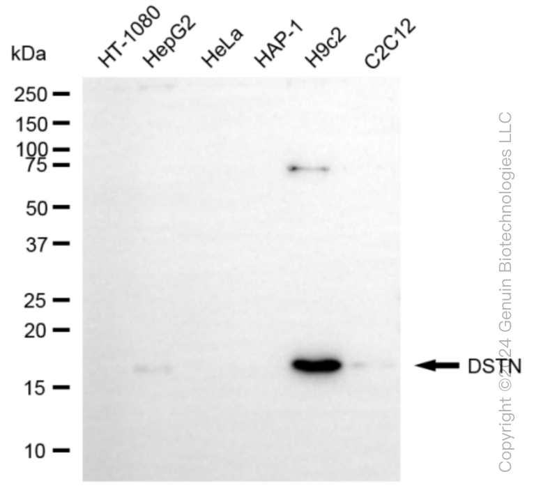 KD-Validated DSTN Rabbit mAb (20 μl) DSTN antibody