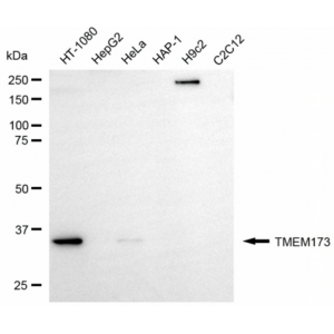 KD-Validated TMEM173 Rabbit mAb (20 μl)