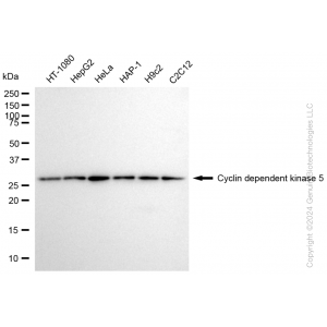 KD-Validated CDK5 Rabbit mAb (20 μl)