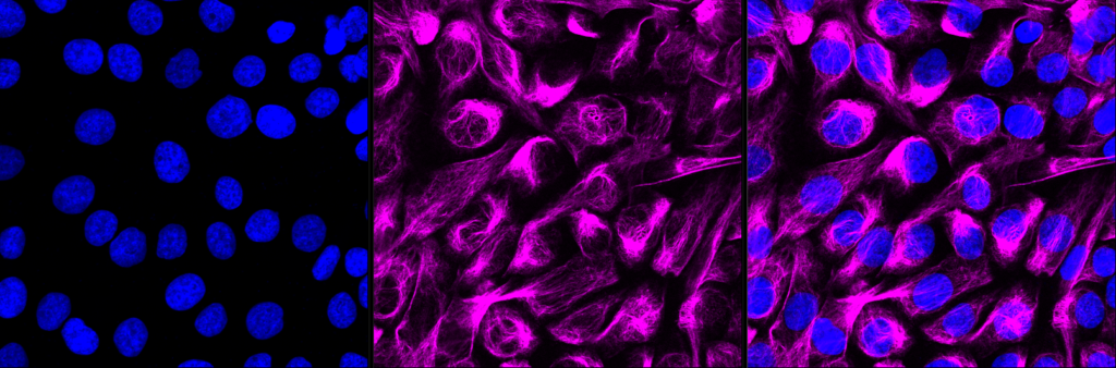 KD-Validated ACAP2 Rabbit mAb (20 μl) ACAP2 Rabbit monoclonal antibody