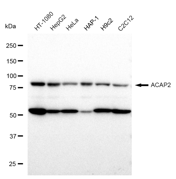 KD-Validated ACAP2 Rabbit mAb (20 μl) ACAP2 Rabbit mAb