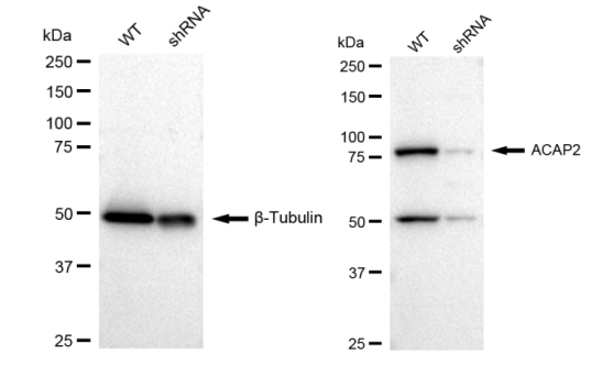KD-Validated ACAP2 Rabbit mAb (20 μl) ABCB1 monoclonal antibody
