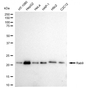 KD-Validated Rab9 Rabbit mAb (20 μl)