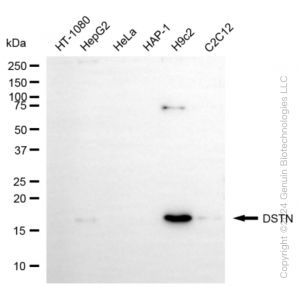 KD-Validated DSTN Rabbit mAb (20 μl)