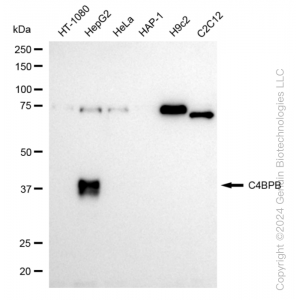 KD-Validated C4BPB Rabbit mAb (20 μl)