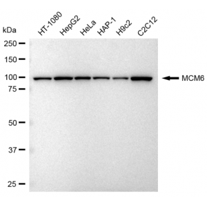 KD-Validated MCM6 Rabbit mAb (20 μl)