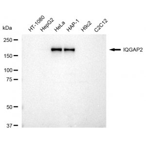 KD-Validated IQGAP2 Rabbit mAb (20 μl)