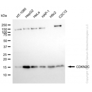 KD-Validated CDKN2C Rabbit mAb (20 μl)