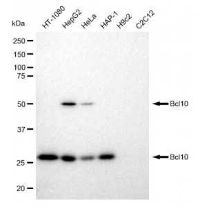 KD-Validated Bcl10 Rabbit mAb (20 μl)