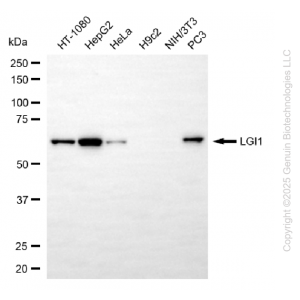 KD-Validated LGI1 Rabbit mAb (20 μl)