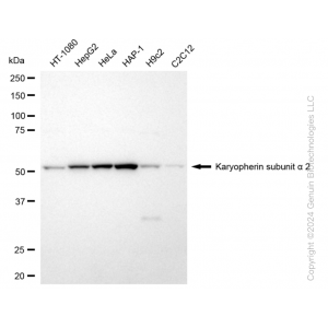 KD-Validated KPNA2 Rabbit mAb (20 μl)