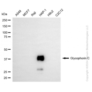 KD-Validated GYPC Rabbit mAb (20 μl)