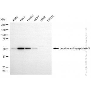KD-Validated LAP3 Rabbit mAb (20 μl)