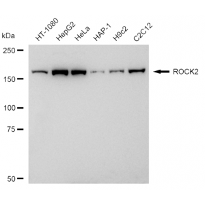 KD-Validated CRT Rabbit mAb (20 μl)