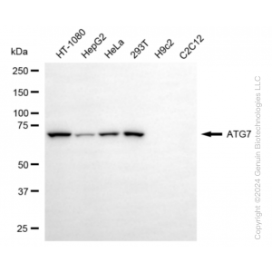 KD-Validated ATG7 Rabbit mAb (20 μl)