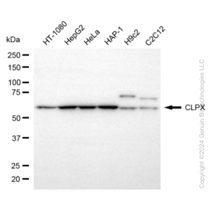 KD-Validated CLPX Rabbit mAb (20 μl)