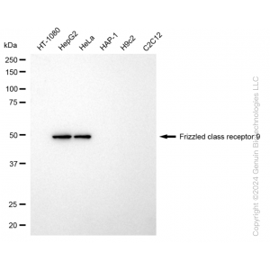 KD-Validated FZD9 Rabbit mAb (20 μl)
