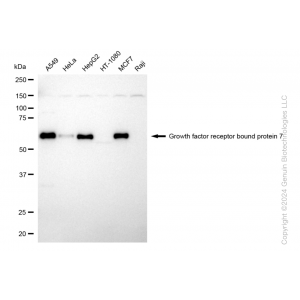 KD-Validated GRB7 Rabbit mAb (20 μl)
