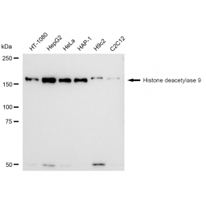 KD-Validated HDAC9 Rabbit mAb (20 μl)