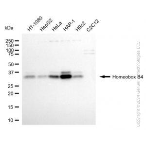 KD-Validated HOXB4 Rabbit mAb (20 μl)