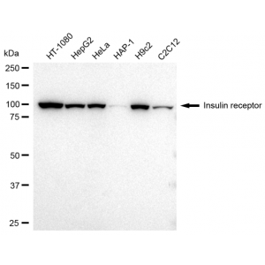 KD-Validated INSR Rabbit mAb (20 μl)
