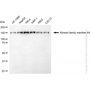 KD-Validated KIF4A Rabbit mAb (20 μl)