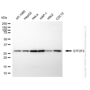 KD-Validated GTF2F2 Rabbit mAb (20 μl)