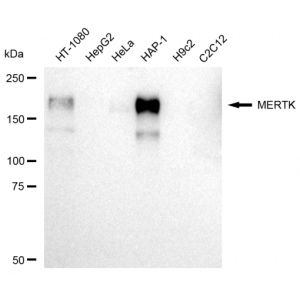 KD-Validated MERTK Rabbit mAb (20 μl)