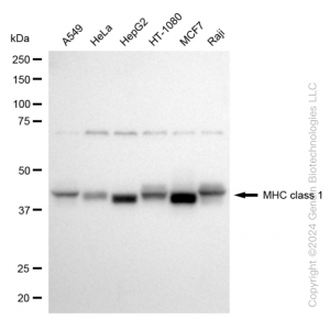 KD-Validated HLA-A Rabbit mAb (20 μl)