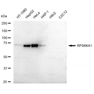 KD-Validated RPS6KA1 Rabbit mAb (20 μl)
