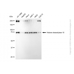 KD-Validated HDAC10 Rabbit mAb (20 μl)