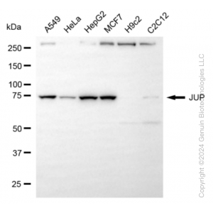 KD-Validated JUP Rabbit mAb (20 μl)