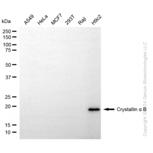 KD-Validated CRYAB Rabbit mAb (20 μl)