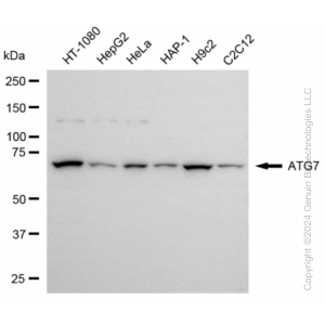 KD-Validated ATG7 Rabbit mAb (20 μl)