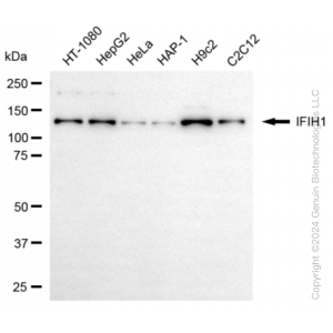 KD-Validated IFIH1 Rabbit mAb (20 μl)