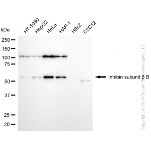 KD-Validated INHBB Rabbit mAb (20 μl)
