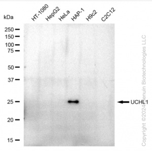 KD-Validated UCHL1 Rabbit mAb (20 μl)