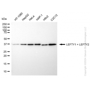 KD-Validated LEFTY1/LEFTY2 Rabbit mAb (20 μl)