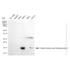 KD-Validated CRABP1 Rabbit mAb (20 μl)