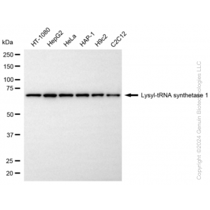 KD-Validated KARS1 Rabbit mAb (20 μl)