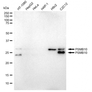 KD-Validated PSMB10 Rabbit mAb (20 μl)