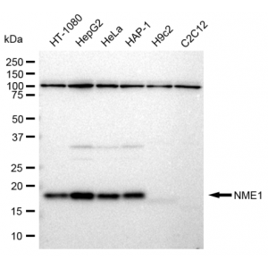 KD-Validated NME1 Rabbit mAb (20 μl)