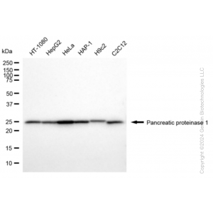 KD-Validated HPRT1 Rabbit mAb (20 μl)