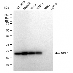 KD-Validated NME1 Rabbit mAb (20 μl)