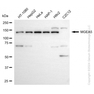 KD-Validated MGEA5 Rabbit mAb (20 μl)