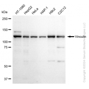 KD-Validated VCL Rabbit mAb (20 μl)