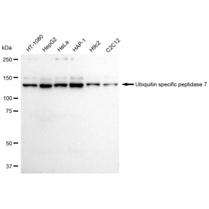 KD-Validated USP7 Rabbit mAb (20 μl)