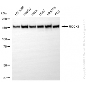 KD-Validated ROCK1 Rabbit mAb (20 μl)