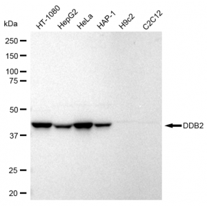 61292-WB-1-300x300 KD-Validated DDB2 Rabbit mAb (20 μl)